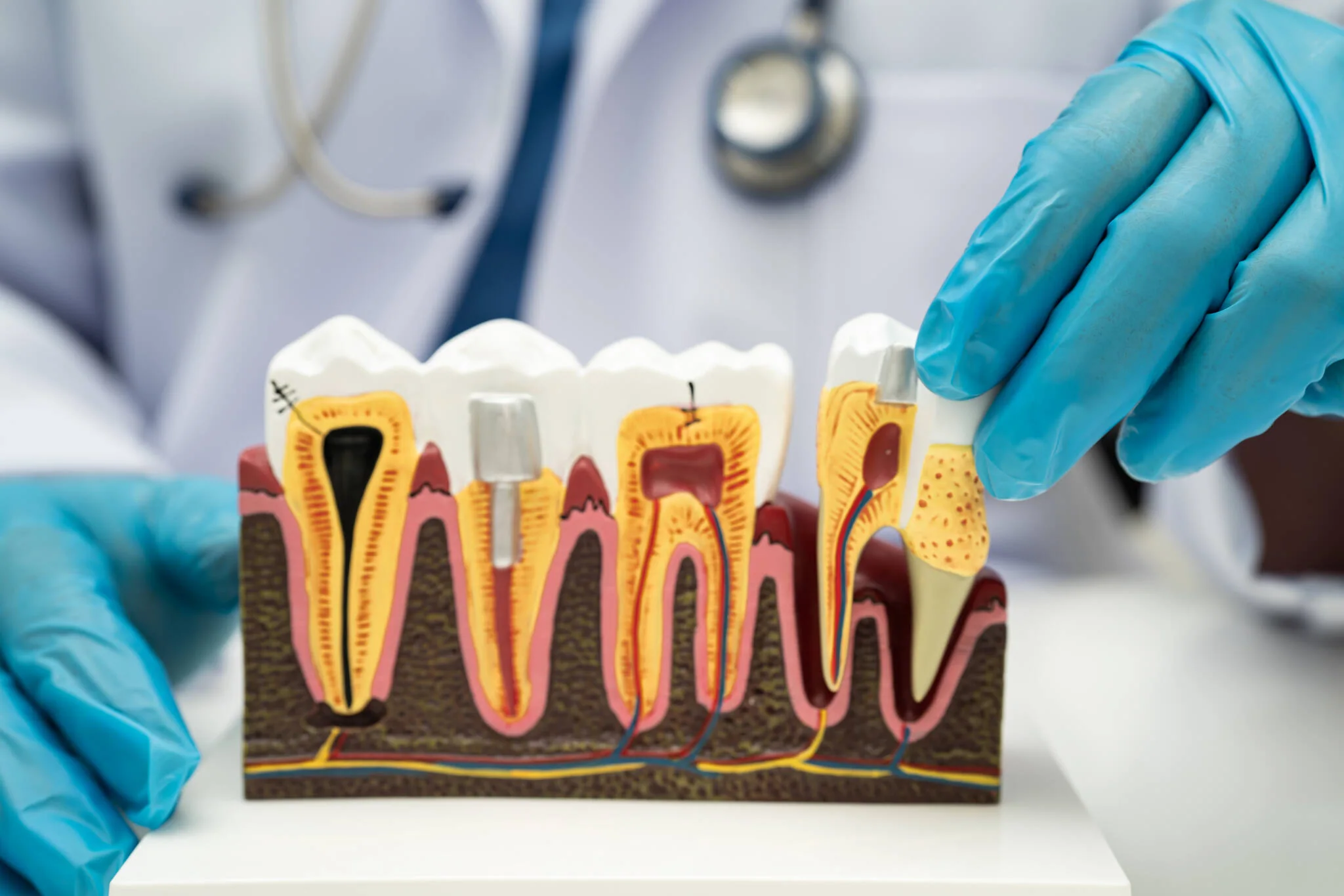 Zahnmedizinischer Schulungsbereich mit einem Zahn- und Implantatmodell