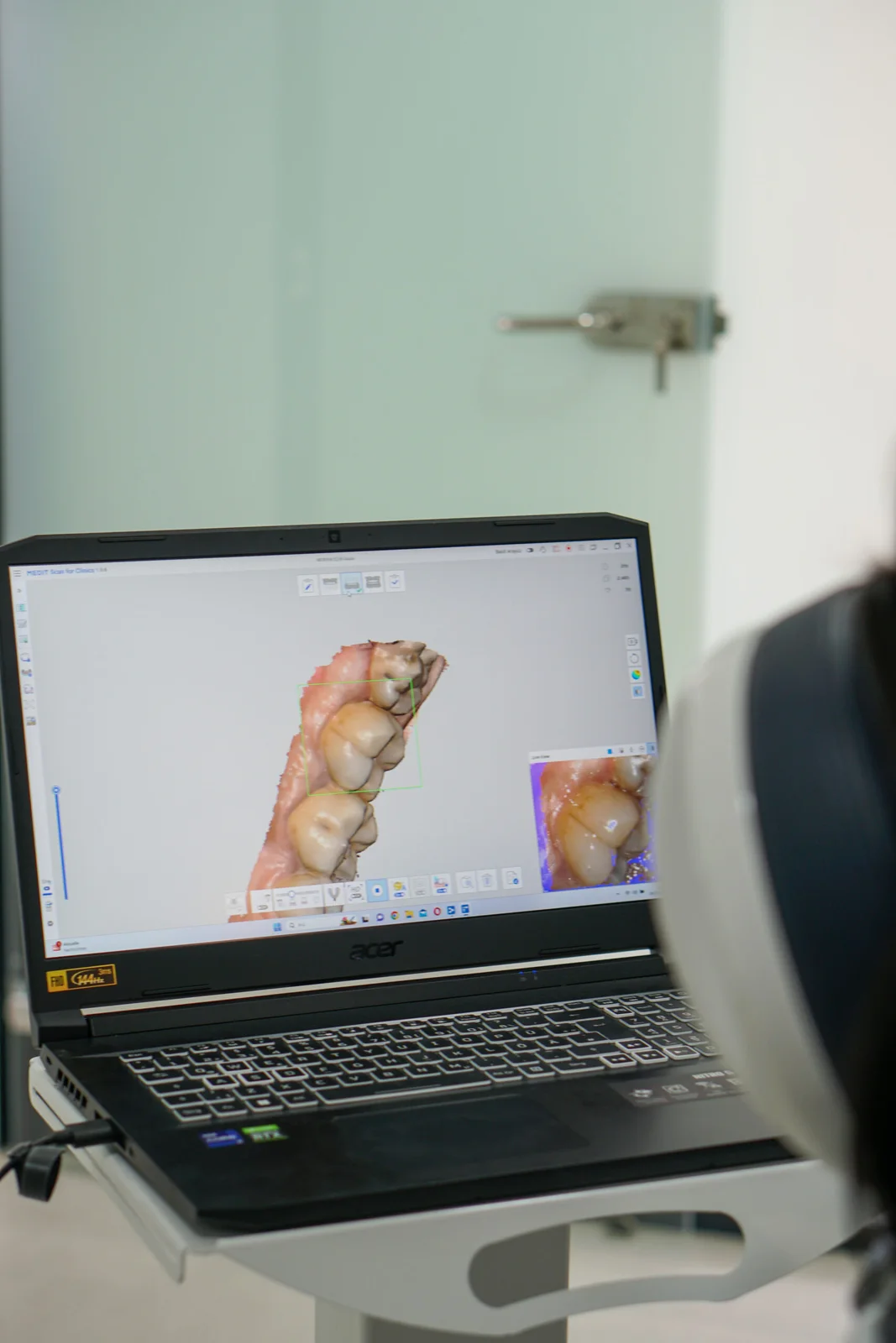 Denteos digital scanning procedure
